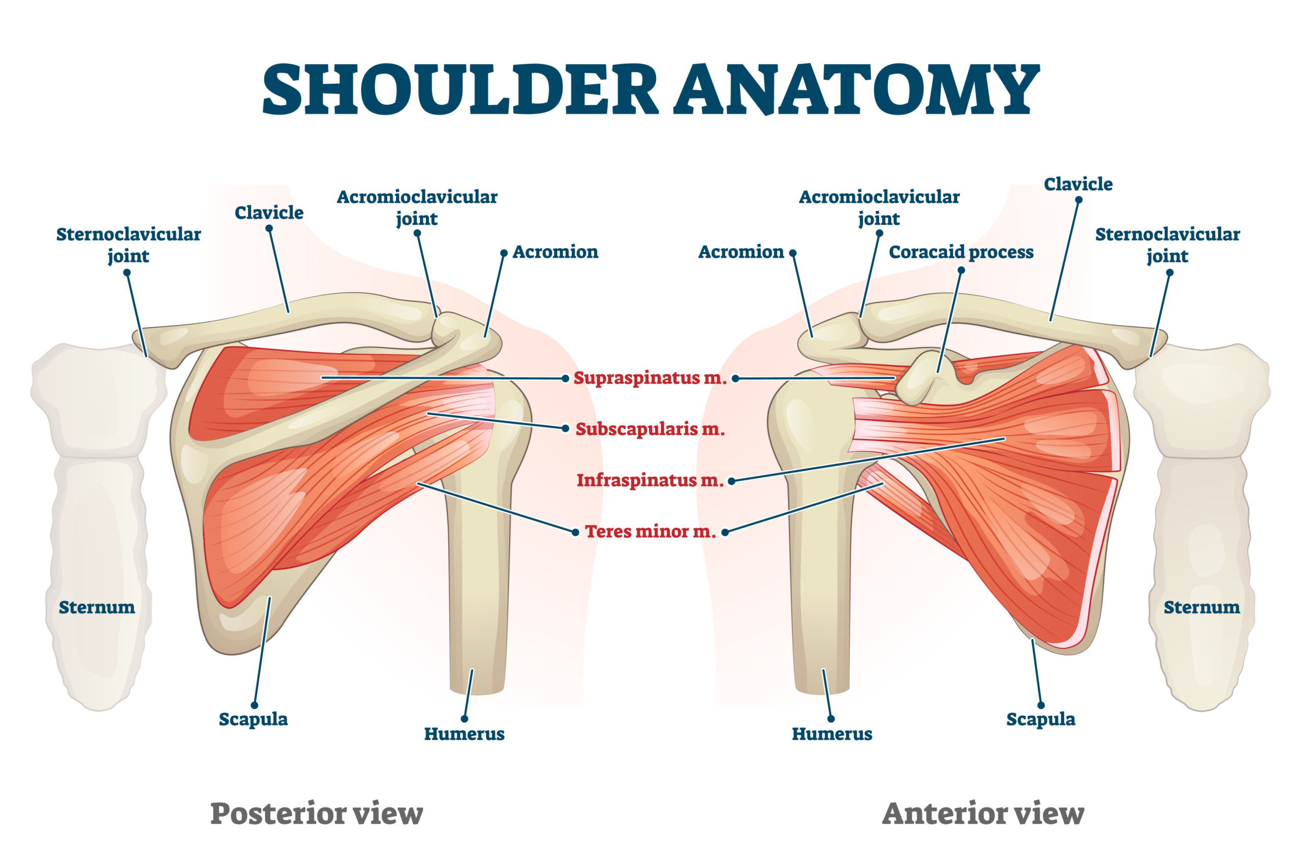 Reverse Total Shoulder Replacement
