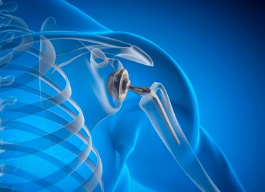 Shoulder Pain Symptoms