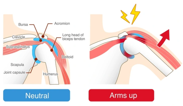 Shoulder Pain Symptoms