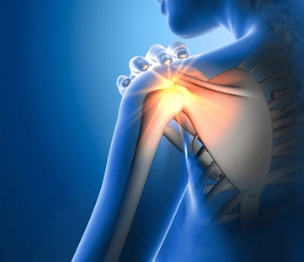 Multidirectional Instability – Atraumatic