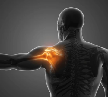 Rheumatoid / Inflammatory Arthritis of the Shoulder