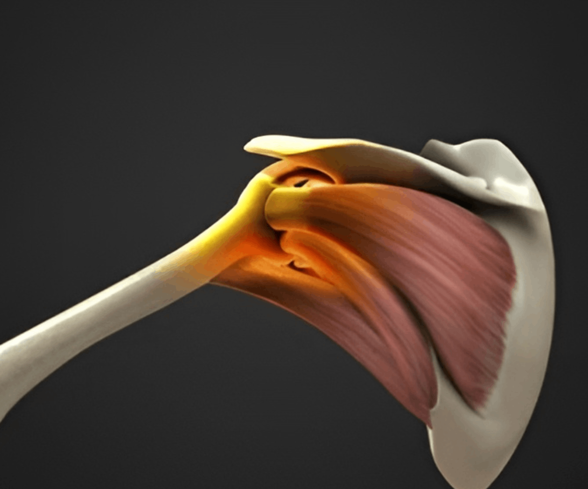 Rotator Cuff Surgery